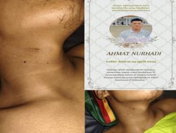 HEBOH! Remaja 17 Tahun Meninggal Secara Janggal di RSJ Tampan, Ketua LSM Penjara DPD Riau Asep Susanto SH: “Tangkap Bila Ada Oknum Terlibat Kekerasan!”